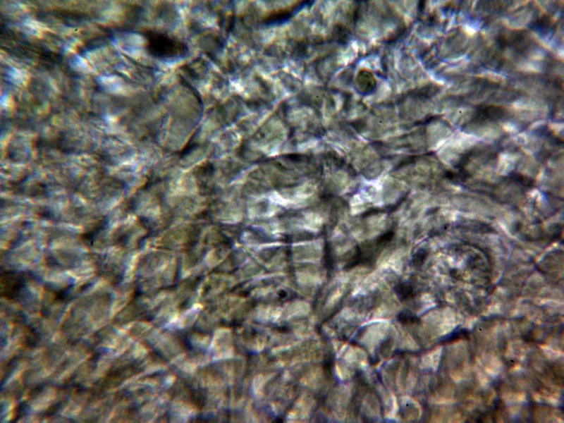 Anthracobia macrocystis 10 - Excípulo medular Melzer